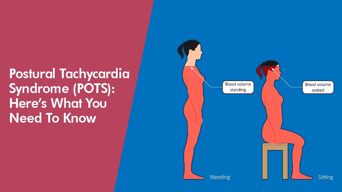 POSTURAL TACHYCARDIA SYNDROME (POTS) – HERE'S WHAT YOU NEED TO KNOW -  German Heart Centre