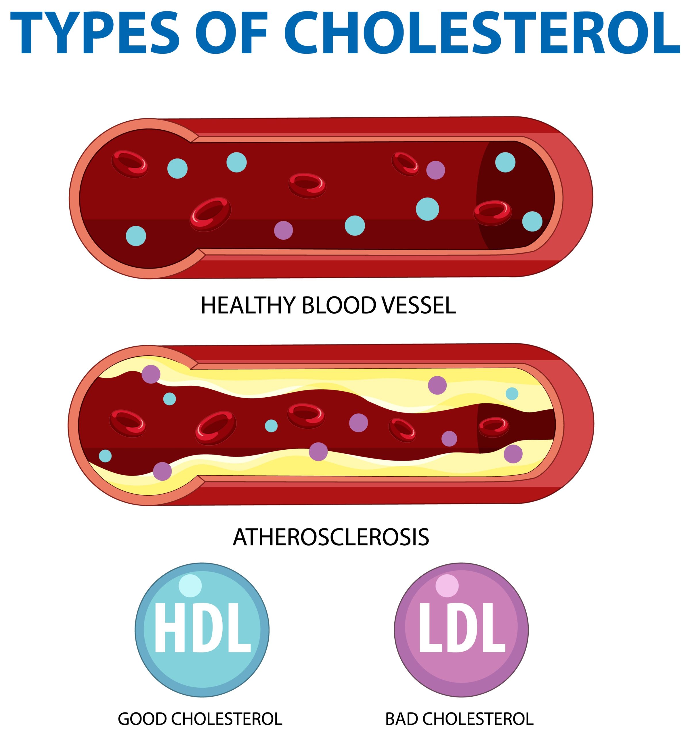 What is Cholesterol? Types of Cholesterol