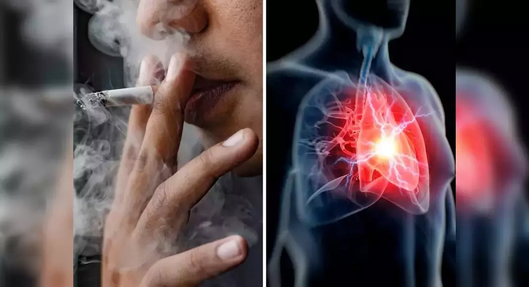 Is Smoking Increasing The Risk Of Heart Attack In Men’s Health