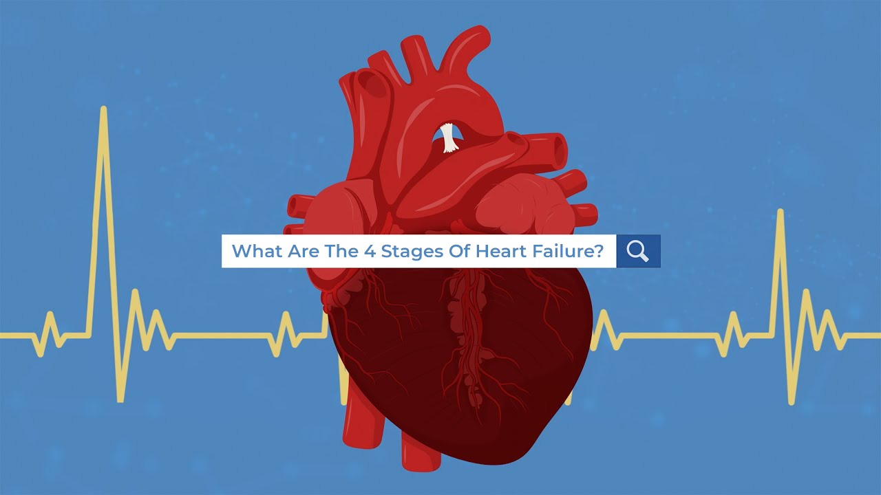What Are The 4 Stages Of Heart Failure?