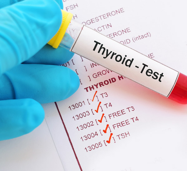 Thyroid Function Tests in Dubai UAE