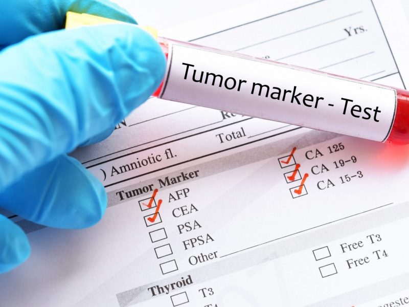 Tumour Markers Test in Dubai